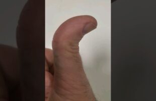 Can Your Thumb Do This?